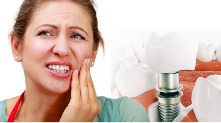 Dentist Supports